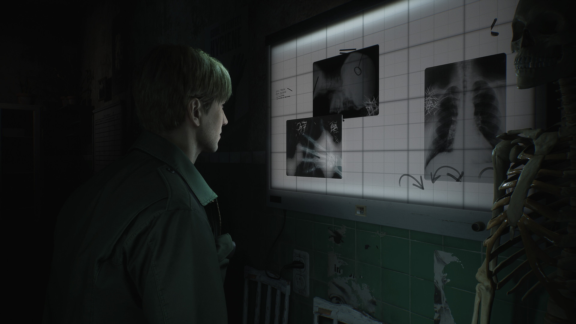 Silent Hill 2 Remake - screenshot 1